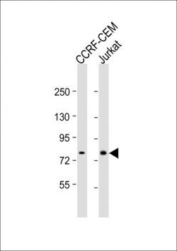Invitrogen MT-ND5 Polyclonal Antibody 400 &mu;L; Unconjugated:Antibodies,