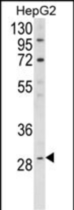Invitrogen DIO1 Polyclonal Antibody 400 &mu;L | Buy Online | Invitrogen&trade; | Fisher Scientific