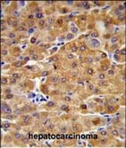 Invitrogen CBS Polyclonal Antibody 400 &mu;L; Unconjugated:Antibodies,