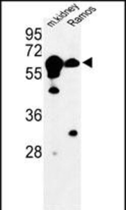 Invitrogen CBS Polyclonal Antibody 400 &mu;L; Unconjugated:Antibodies,