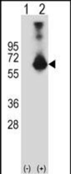Invitrogen CBS Polyclonal Antibody 400 &mu;L; Unconjugated:Antibodies,