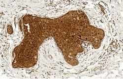 Invitrogen BCOR Polyclonal Antibody 400 &mu;L; Unconjugated:Antibodies,