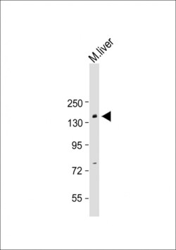 Invitrogen BCOR Polyclonal Antibody 400 &mu;L; Unconjugated:Antibodies,