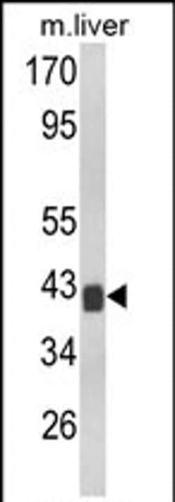 TOB1 Rabbit anti-Human, Mouse, Polyclonal, Invitrogen 400 &mu;L; Unconjugated:Antibodies,
