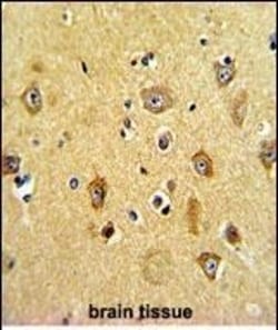 Invitrogen PPP2R2B Polyclonal Antibody 400 &mu;L; Unconjugated:Antibodies,