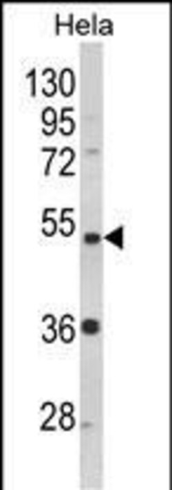 Invitrogen PPP2R2B Polyclonal Antibody 400 &mu;L; Unconjugated:Antibodies,
