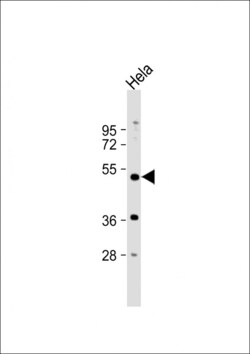 Invitrogen PXR Polyclonal Antibody 400 &mu;L | Buy Online | Invitrogen&trade; | Fisher Scientific