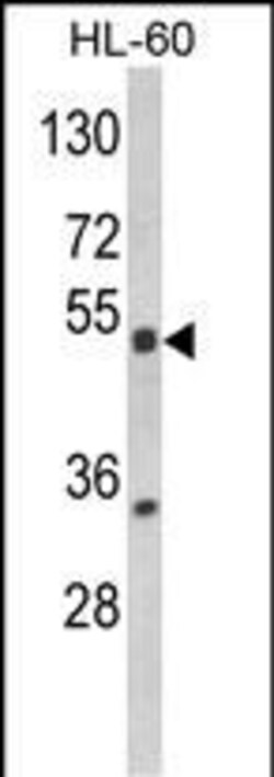 Invitrogen PXR Polyclonal Antibody 400 &mu;L | Buy Online | Invitrogen&trade; | Fisher Scientific