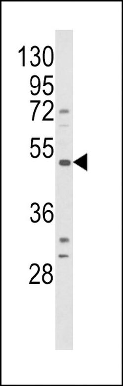 B1 Bradykinin Receptor Rabbit anti-Human, Polyclonal, Invitrogen 400 &mu;L;