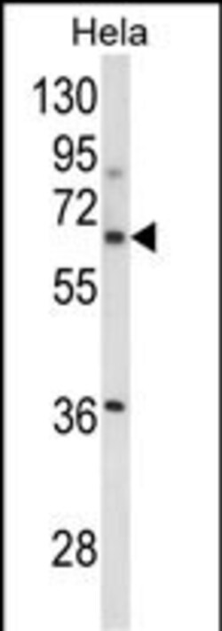 Invitrogen ITGBL1 Polyclonal Antibody 400 &mu;L; Unconjugated:Antibodies,