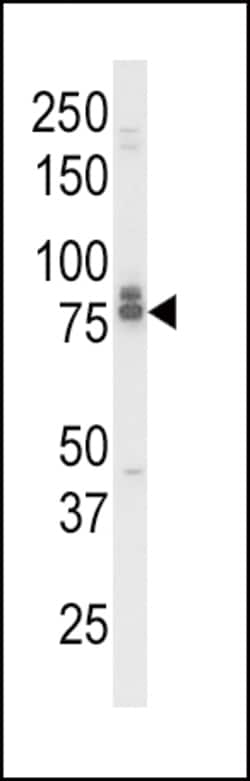 Invitrogen IL18RAP Polyclonal Antibody 400 &mu;L; Unconjugated:Antibodies,