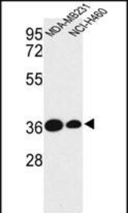 Invitrogen TAZ Polyclonal Antibody 400 &mu;L; Unconjugated:Antibodies,