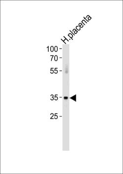 ATF7 Rabbit anti-Human, Polyclonal, Invitrogen 400 &mu;L; Unconjugated:Antibodies,