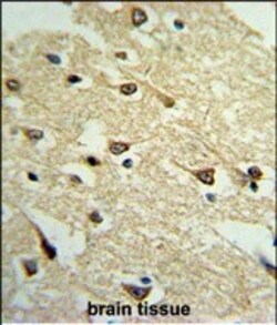 Invitrogen Adenylate Cyclase 8 Polyclonal Antibody 400 &mu;L; Unconjugated:Antibodies,