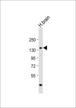 Invitrogen Adenylate Cyclase 8 Polyclonal Antibody 400 &mu;L; Unconjugated:Antibodies,