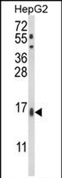 MGST2 Rabbit anti-Human, Polyclonal, Invitrogen 400 &mu;L; Unconjugated:Antibodies,