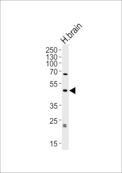 Invitrogen ABHD12 Polyclonal Antibody 400 &mu;L | Buy Online | Invitrogen&trade; | Fisher Scientific