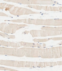 GBA Polyclonal Antibody:Antibodies, Polyclonal