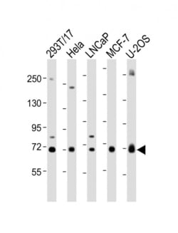 GBA Polyclonal Antibody:Antibodies, Polyclonal