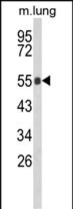 GBA Polyclonal Antibody:Antibodies, Polyclonal