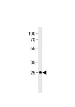 Invitrogen DLX6A Polyclonal Antibody 400 &mu;L; Unconjugated:Antibodies,
