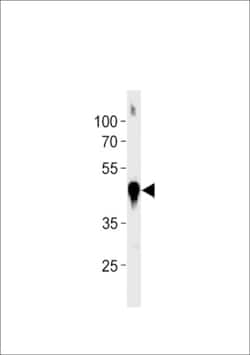 Invitrogen beta Actin Polyclonal Antibody 400 &mu;L; Unconjugated:Antibodies,