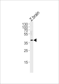 Invitrogen HEY2 Polyclonal Antibody 400 &mu;L; Unconjugated:Antibodies,