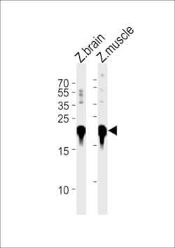 Invitrogen DJ-1 Polyclonal Antibody 400 &mu;L; Unconjugated:Antibodies,