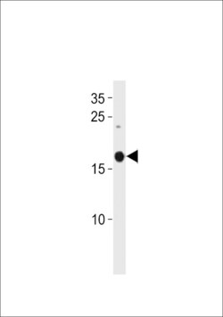 SELM Polyclonal Antibody:Antibodies, Polyclonal