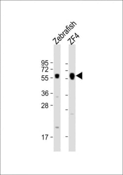 Invitrogen FOXH1 Polyclonal Antibody 400 &mu;L; Unconjugated:Antibodies,