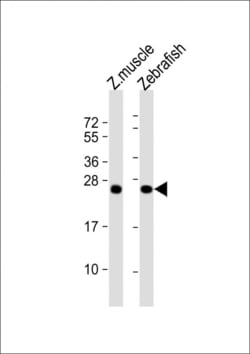 Invitrogen DUSP22A Polyclonal Antibody 400 &mu;L; Unconjugated:Antibodies,