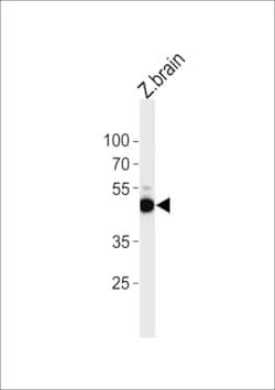 Invitrogen ATG4B Polyclonal Antibody 400 &mu;L; Unconjugated:Antibodies,