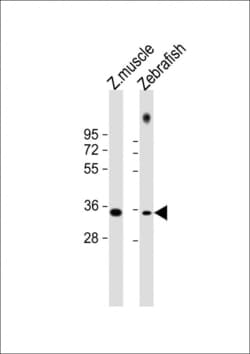Invitrogen PAX9 Polyclonal Antibody 400 &mu;L | Buy Online | Invitrogen&trade; | Fisher Scientific