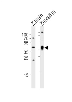 Invitrogen™ Adenosine Deaminase Polyclonal Antibody