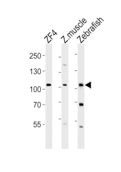 Invitrogen CCP2 Polyclonal Antibody 400 &mu;L; Unconjugated:Antibodies,