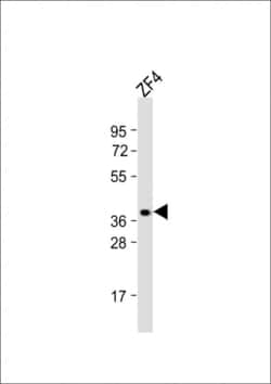 Invitrogen OPN1SW2 Polyclonal Antibody 200 &mu;L; Unconjugated:Antibodies,