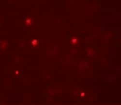 Invitrogen KCNK13 Polyclonal Antibody 100 &mu;g; Unconjugated:Antibodies,
