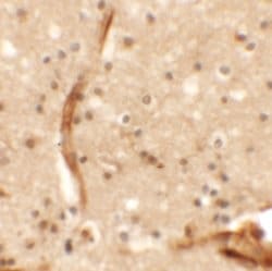 Invitrogen KCNK13 Polyclonal Antibody 100 &mu;g; Unconjugated:Antibodies,