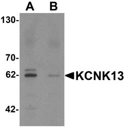 Invitrogen KCNK13 Polyclonal Antibody 100 &mu;g; Unconjugated:Antibodies,