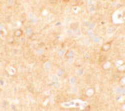 Invitrogen KCNK12 Polyclonal Antibody 100 &mu;g; Unconjugated:Antibodies,