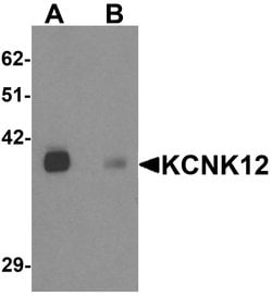 Invitrogen KCNK12 Polyclonal Antibody 100 &mu;g; Unconjugated:Antibodies,