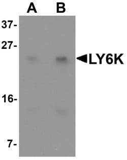 Invitrogen LY6K Polyclonal Antibody 100 &mu;g; Unconjugated:Antibodies,