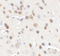 Invitrogen CHD7 Polyclonal Antibody 100 &mu;g; Unconjugated:Antibodies,