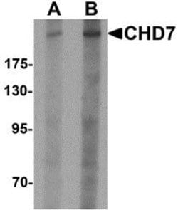 Invitrogen CHD7 Polyclonal Antibody 100 &mu;g; Unconjugated:Antibodies,