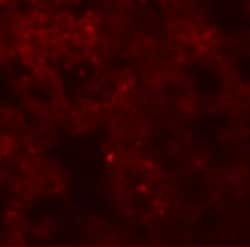 Invitrogen Coronin 7 Polyclonal Antibody 100 &mu;g; Unconjugated:Antibodies,