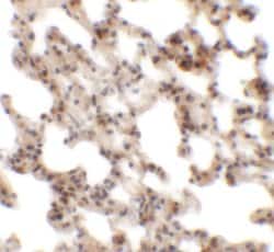 Invitrogen Coronin 7 Polyclonal Antibody 100 &mu;g; Unconjugated:Antibodies,