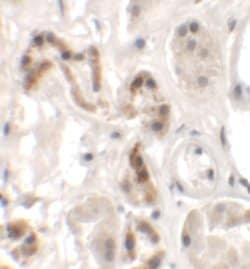 Invitrogen DBX1 Polyclonal Antibody 100 &mu;g; Unconjugated:Antibodies,