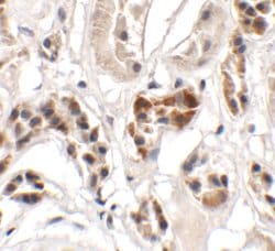 Invitrogen UHRF1BP1 Polyclonal Antibody 100 &mu;g | Buy Online | Invitrogen&trade; | Fisher Scientific
