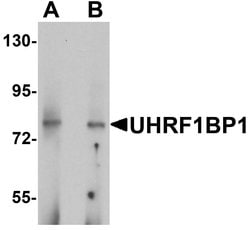 Invitrogen UHRF1BP1 Polyclonal Antibody 100 &mu;g | Buy Online | Invitrogen&trade; | Fisher Scientific