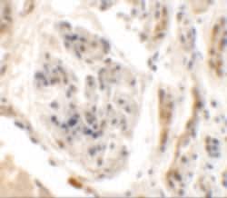 Invitrogen KIAA0701 Polyclonal Antibody 100 &mu;g; Unconjugated:Antibodies,